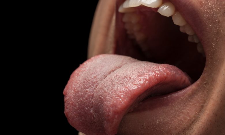 aliviar las quemaduras en la lengua