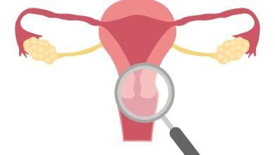 Ilustración de un sistema reproductor femenino siendo revisado con lupa, en busca de micosis vaginal