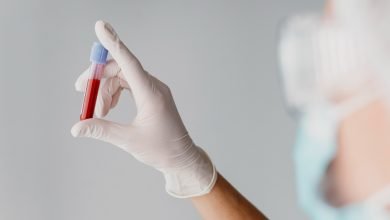 Bacteriólogo con muestra de sangre en su mano, para examinar si hay anemia / limpiar la sangre