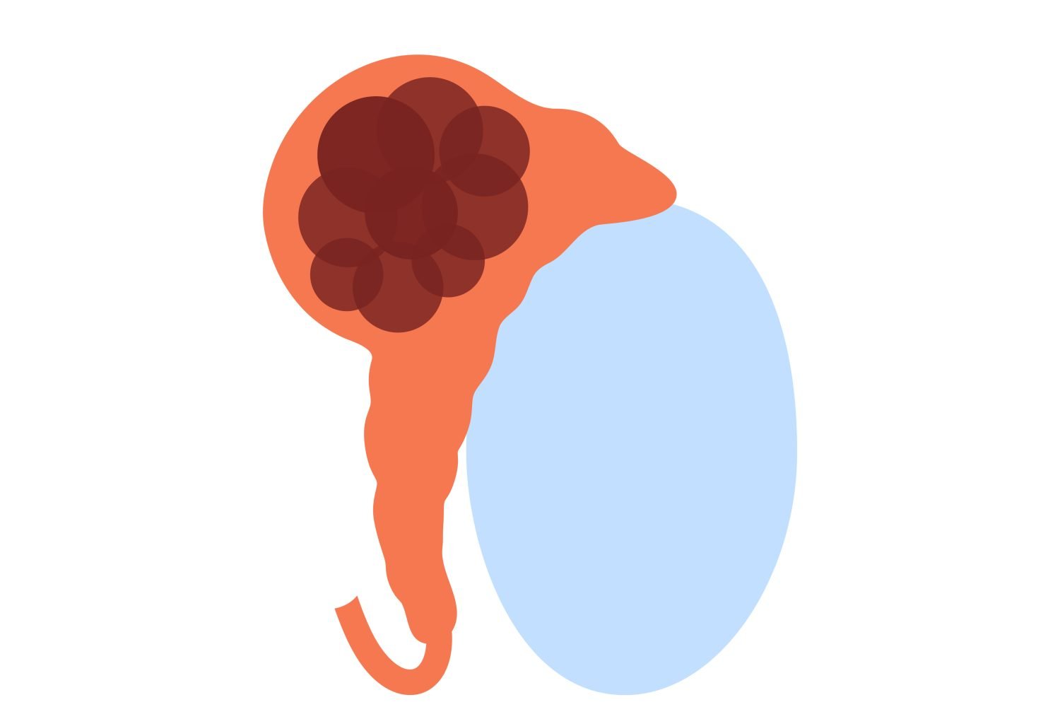 Ilustración de cáncer de testículo