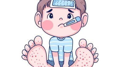Ilustración de niño con enfermedad de manos, pies y boca