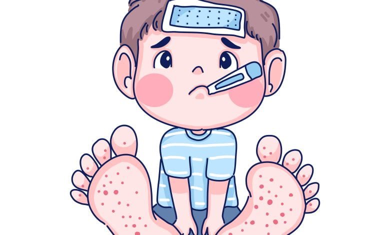 Ilustración de niño con enfermedad de manos, pies y boca