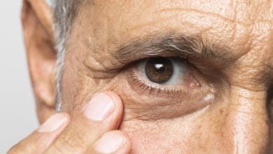 consejos de expertos para prevenir y controlar las cataratas